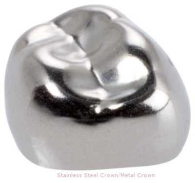 Stainless steel Crown